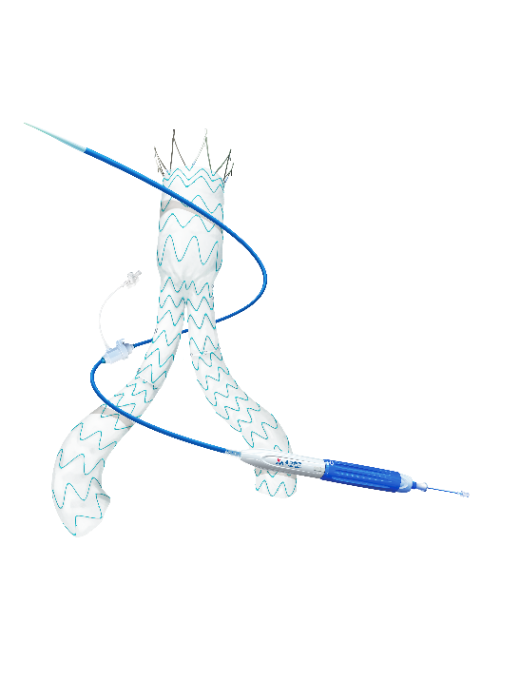 Minos?腹主動(dòng)脈覆膜支架及輸送系統(tǒng)-1