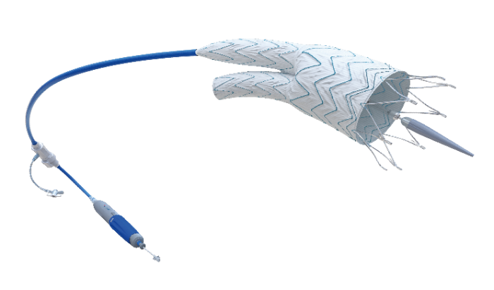 Minos?腹主動(dòng)脈覆膜支架及輸送系統(tǒng)-2