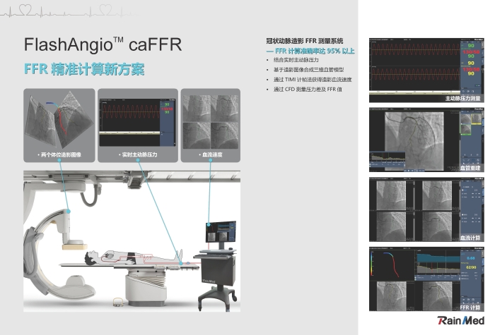 冠狀動脈造影血流儲備分?jǐn)?shù)測量系統(tǒng)圖片3