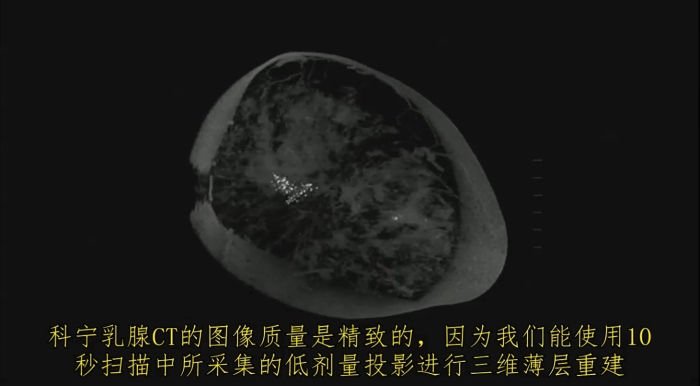 KBCT產(chǎn)品優(yōu)勢(shì)4