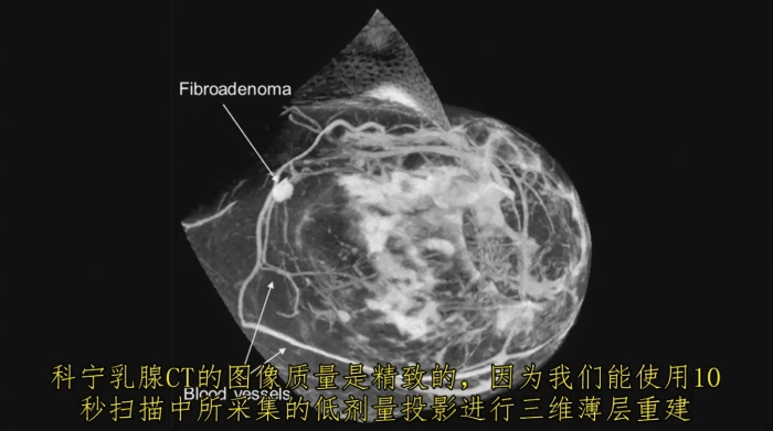 KBCT產(chǎn)品優(yōu)勢(shì)4-1