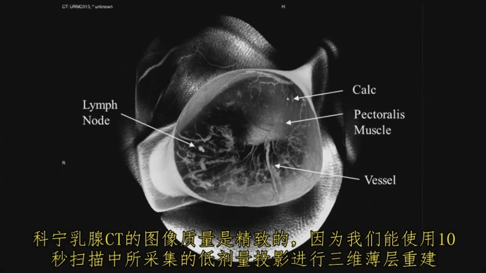 KBCT產(chǎn)品優(yōu)勢(shì)4-2