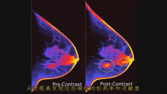 KBCT產(chǎn)品優(yōu)勢(shì)5