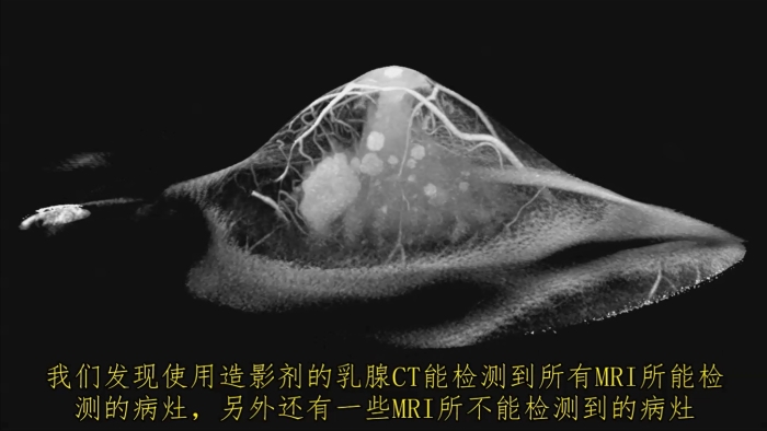 KBCT產(chǎn)品優(yōu)勢(shì)7