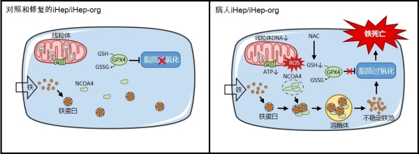線粒體疾病肝細胞的全新鐵死亡模式、細胞器互作機制